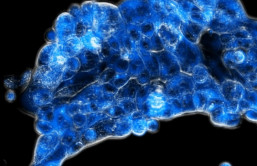 Abbildung 1: Die neue Strategie aktiviert den Wirkstoff (blau fluoreszierend) spezifisch im sauerstoffarmen Tumorgewebe (Copyright: Diana Groza)