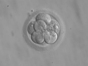 8-zelliger menschlicher Embryo an Tag 3 nach der Befruchtung (© ekem, Wikimedia Commons)
